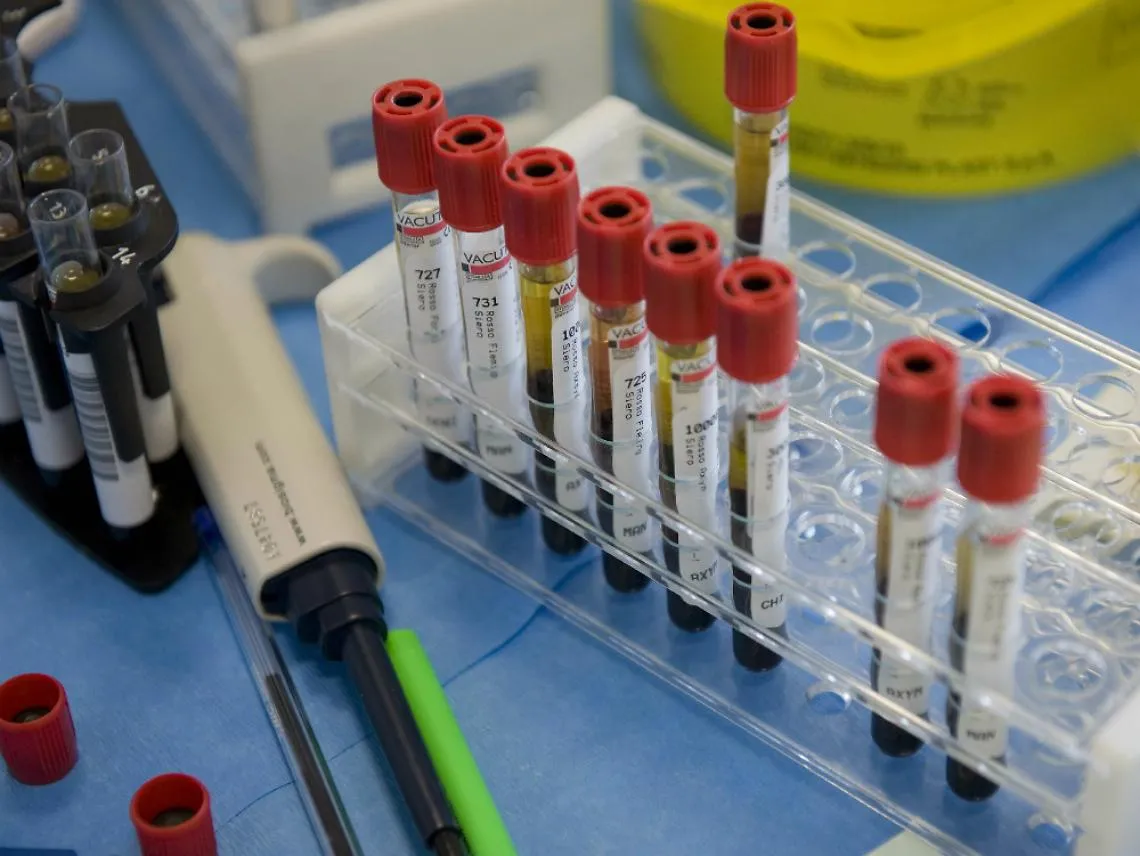 Torna il km0 alla mensa dell'ospedale<br/>Poche certezze sul laboratorio analisi